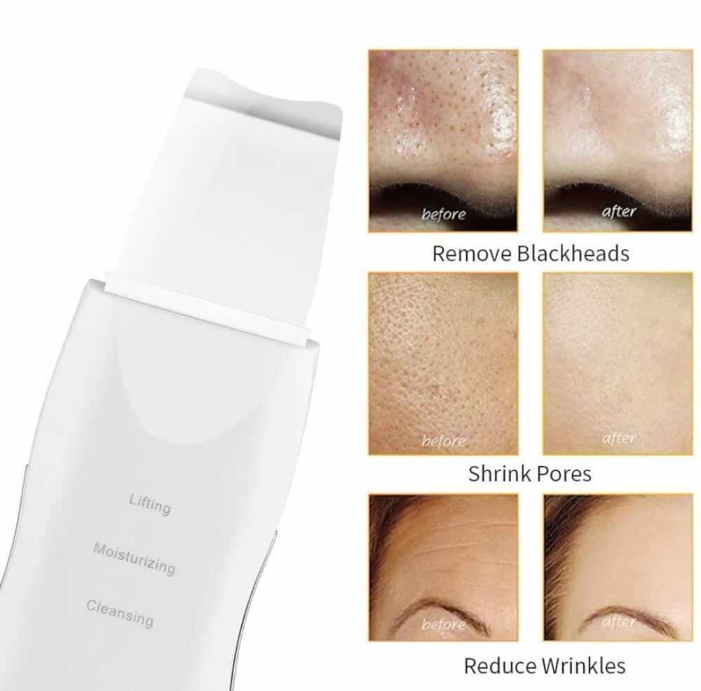 اتو صورت التراسونیک شاول SHOVEL SKIN MACHINE MOISTURIZING CLEAN - Image 5