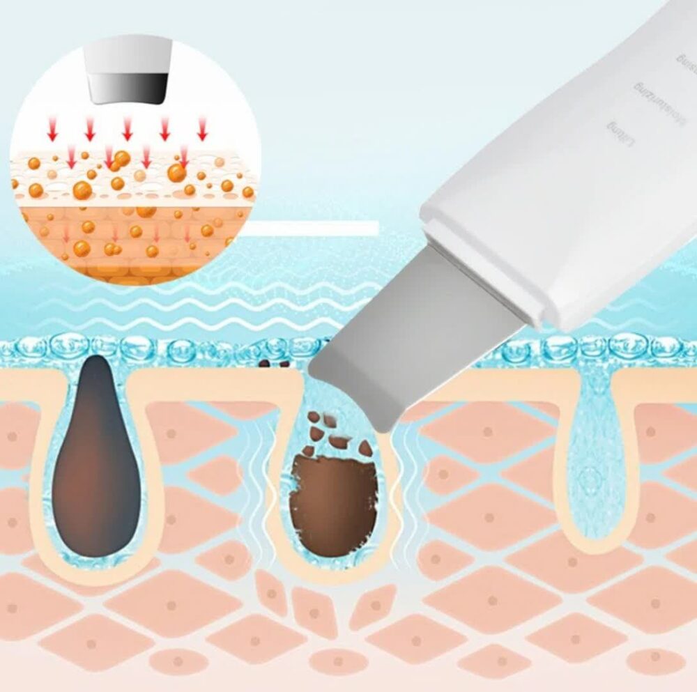 اتو صورت التراسونیک شاول SHOVEL SKIN MACHINE MOISTURIZING CLEAN - Image 6