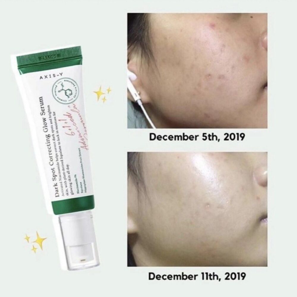 سرم ضد لک اکسیس وای مدل Dark Spot حجم 50 میلی لیتر - Image 5